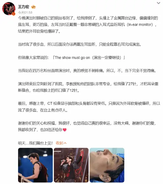 太敬业!王力宏外耳软骨撞碎缝了39针:明日仍上台