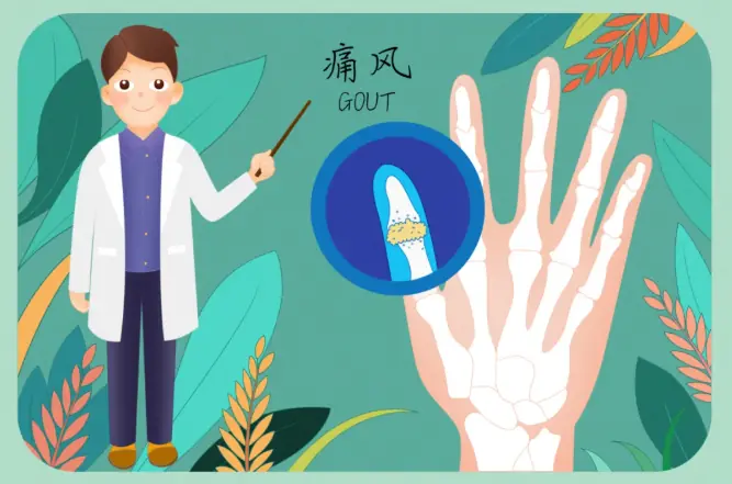 科普时间丨尿酸高但关节不痛,就不用管吗?